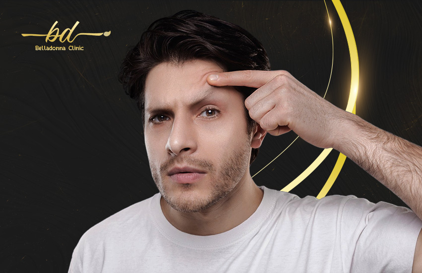 زراعة شعر الحواجب