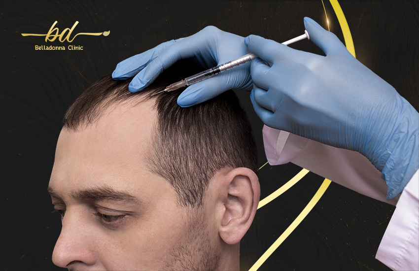 عمليات زراعة الشعر