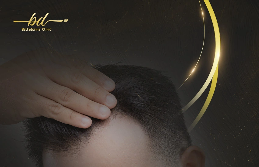علاج-فراغات-الشعر علاج فراغات الشعر