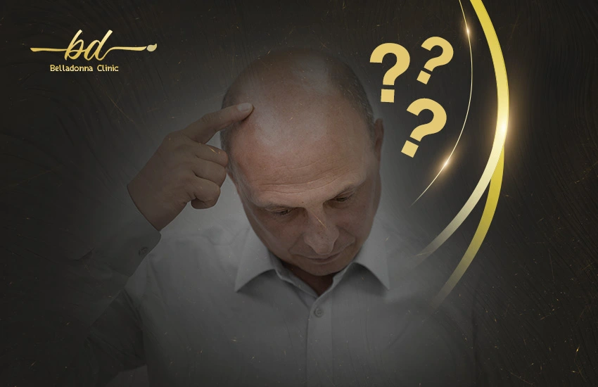 هل يمكن زراعة الشعر مرتين