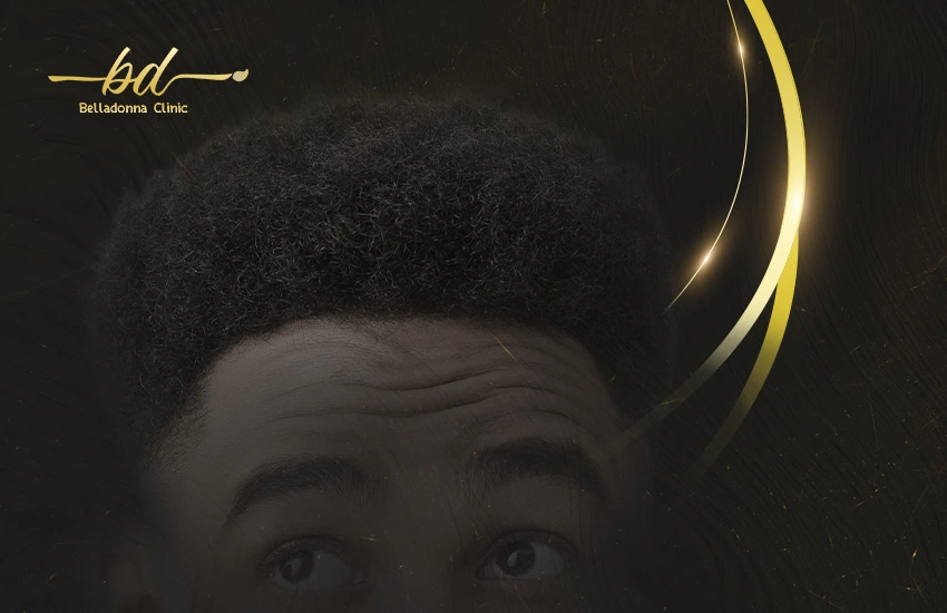 الشعر المزروع خشن