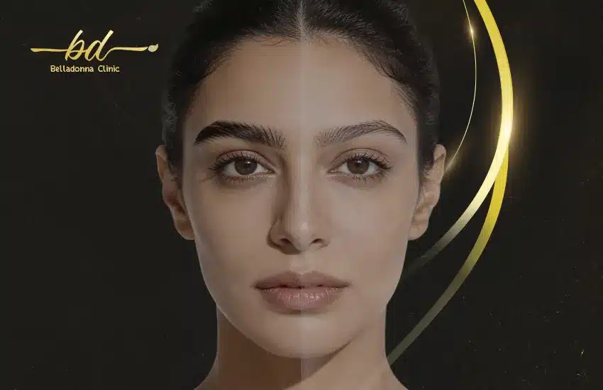 زراعة شعر الحواجب قبل وبعد